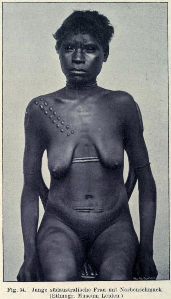 034. Junge südaustralische Frau mit Narbenschmuck