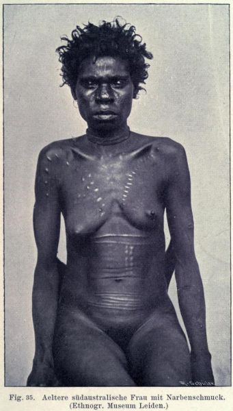 035. Ältere südaustralische Frau mit Narbenschmuck