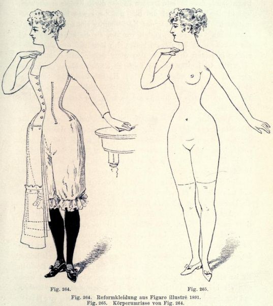 264. Reformkleidung aus Figaro illustre. 1891 und 265. Körperumrisse von Fig. 264