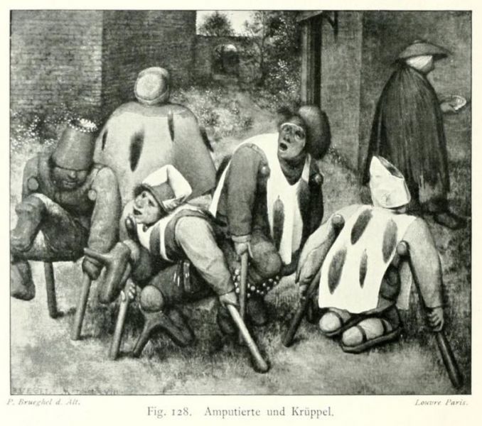 128 Amputierte und Krüppel