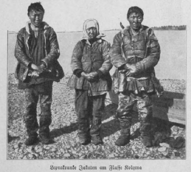 04 Leprakranke Jakuten am Fluss Kolyma