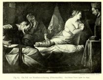 065 Ein Fall von Knochenvereiterung (Osteomyelitis). Von Simon Vouet (1582-1641)