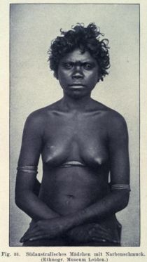 033. Südaustralisches Mädchen mit Narbenschmuck