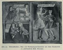 091. Hämorrhoiden-, Star- und Nasenpoypen-Operation aus einer Handschrift 11. Jahrhundert (Brit. Museum)