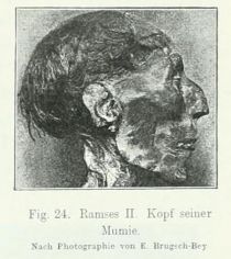 024. RamsesII. Kopf seiner Mumie