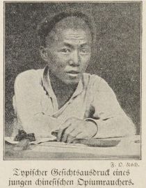 11. Typischer Gesichtsausdruck eines jungen chinesischen Opiumrauchers.  